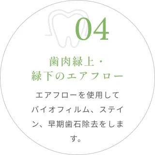 04｜歯肉緑上・緑下のエアフロー｜エアフローを使用してバイオフィルム、ステイン、早期歯石除去をします。